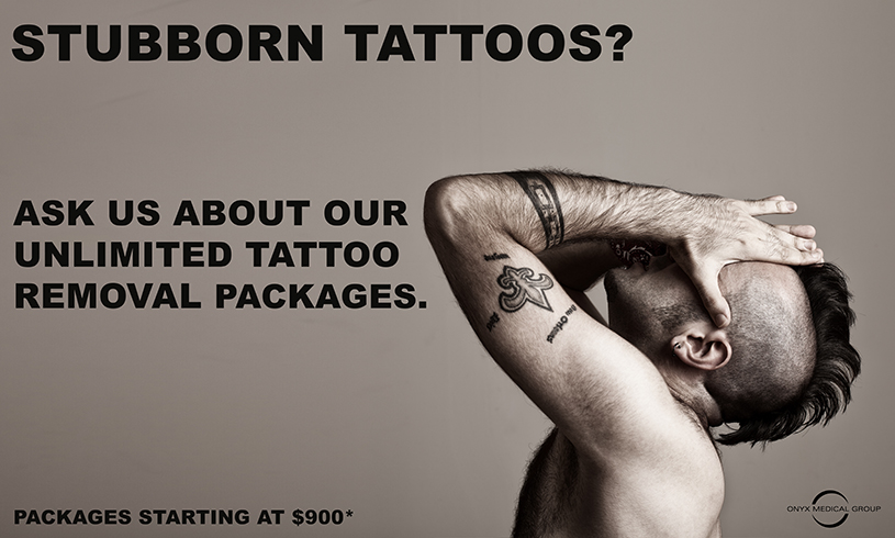 Your Ultimate Guide To Fotona Tattoo Removal Treatment- Dr Tanja Phillips  Clinic